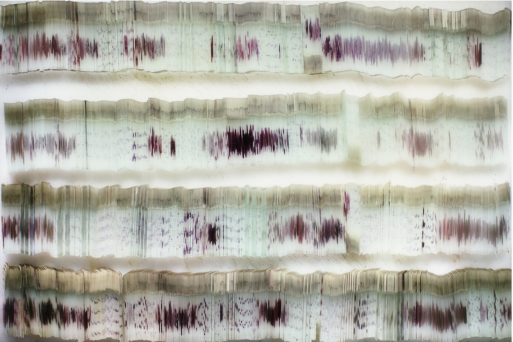 05 Slides containing sheets of cancer , 2008