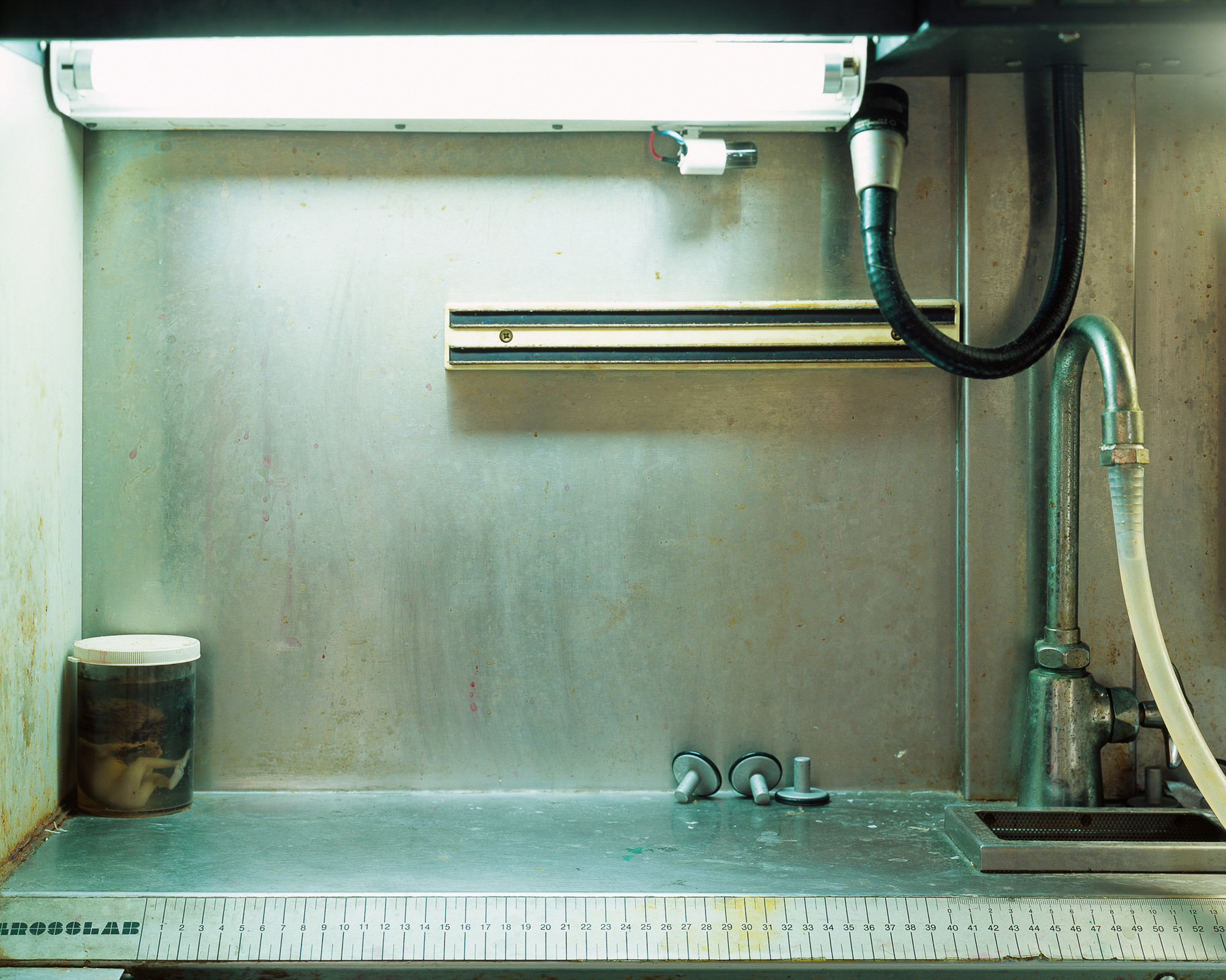 19 Dead fetus in manipulating Chamber , 2006