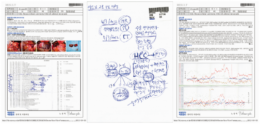 JSN-15 Mr. Kim, 81yo, Asan, C22 Liver 2012