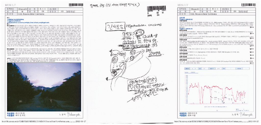 JSN-16 Mr. Oh, 64yo, Hanam, C22 Liver 2012