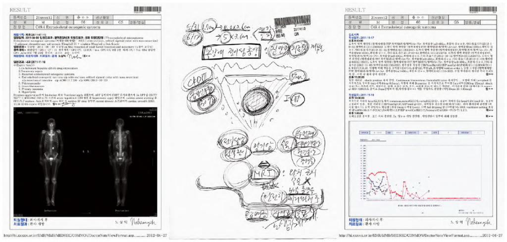 JSN-18 Mr. Yoo, 65yo, Donam-dong, C49.4 Extraskeletal osteogenic sarcoma 2012