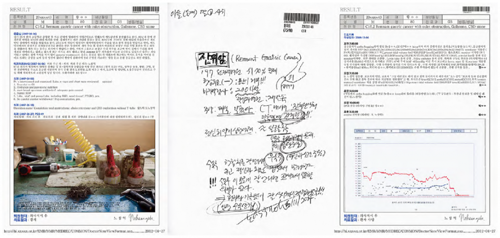 JSN-19 Mr.hwang, 77yo, Pyeongtaek, C16 Stomach 2012