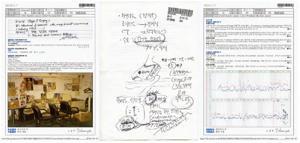 JSN-20 Mr. Choi, 62yo, Namyangju, C24 Bile duct 2012