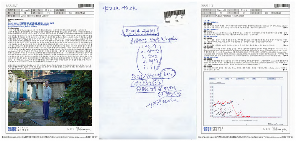 JSN-21 Mr. Kim, 71yo, Pyeongannam-do, C25 Pancreas 2012
