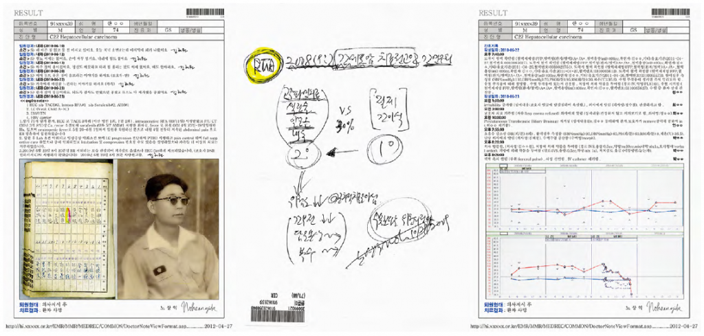 JSN-22 Mr. Han, 74yo, Songpa, Seoul, C22.0 Liver 2012
