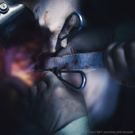 JSN-48 Retractors i situ #01 2014