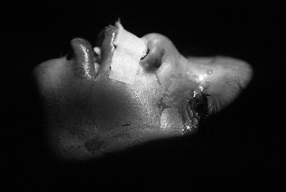 Cleft lip_Pigment print_20x24in_2012
