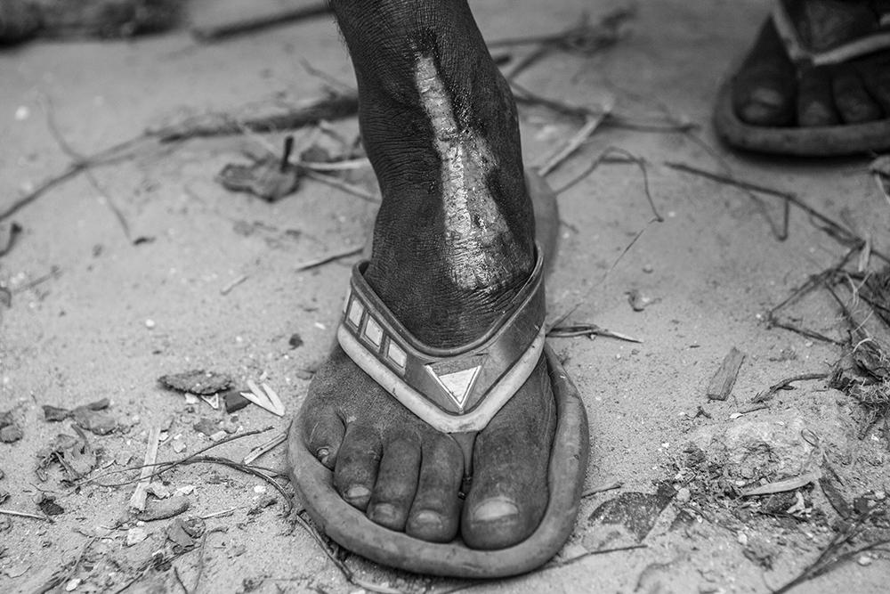 Feet Fortdauphin_Pigment print_12x18in_2012