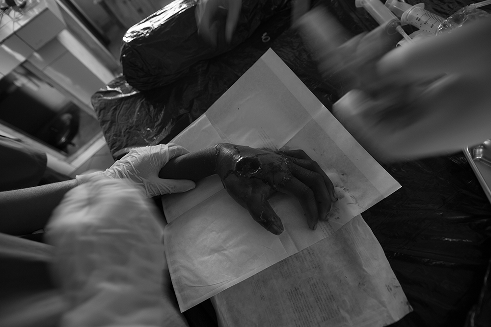 Infected hand_Pigment print_12x18in_2012